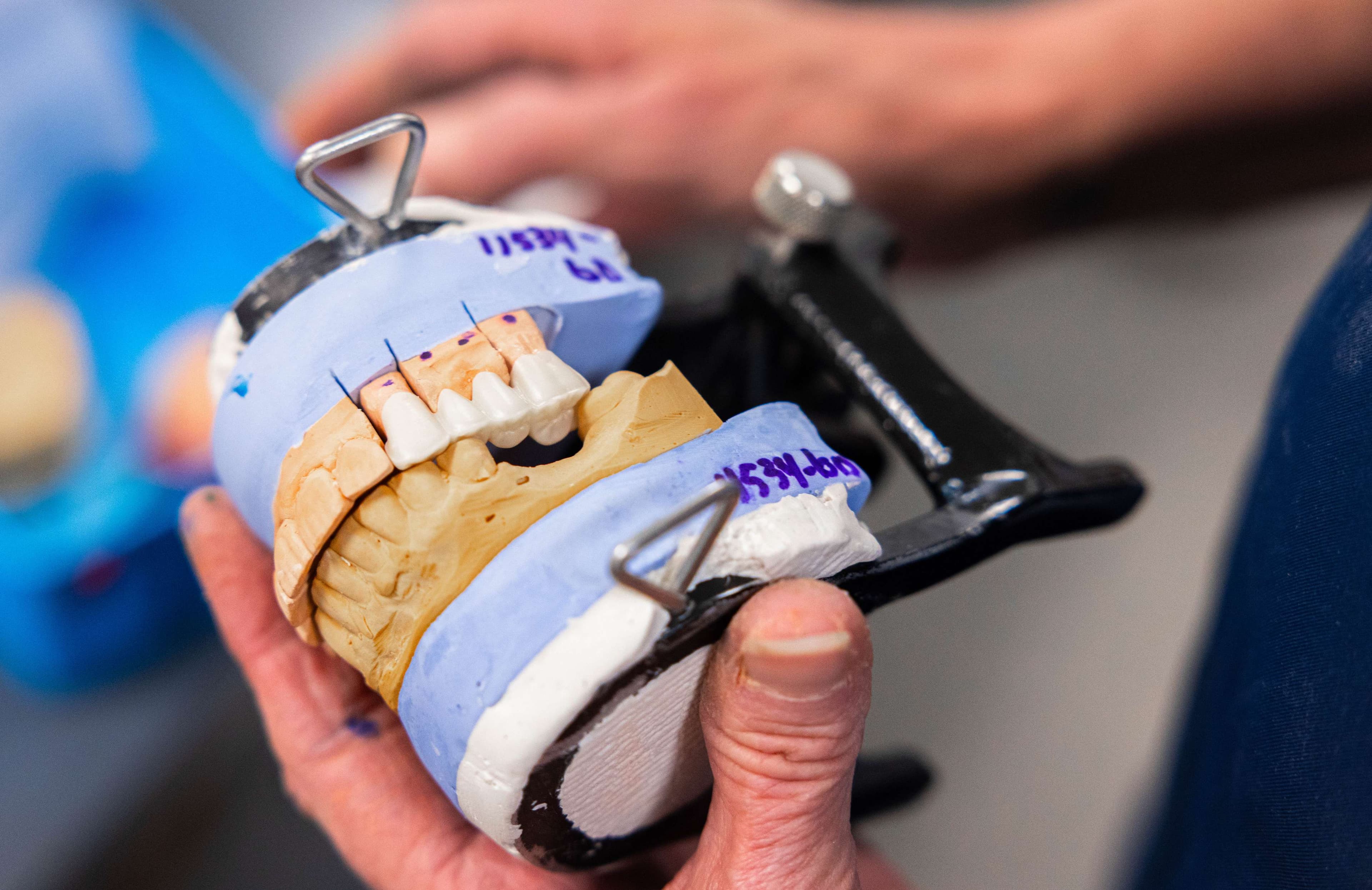 Arch Dental Arts lab photo 156